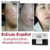 Wink White Gluta Pancea Dietary Acne Supplement 