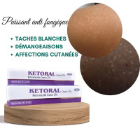Ketoral Ketoconazole Cream 30g